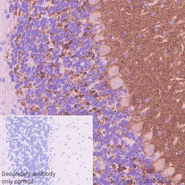 Immunohistochemistry (Formalin/PFA-fixed paraffin-embedded sections) - Anti-SYT2 antibody [ZNP-1] (AB154035)