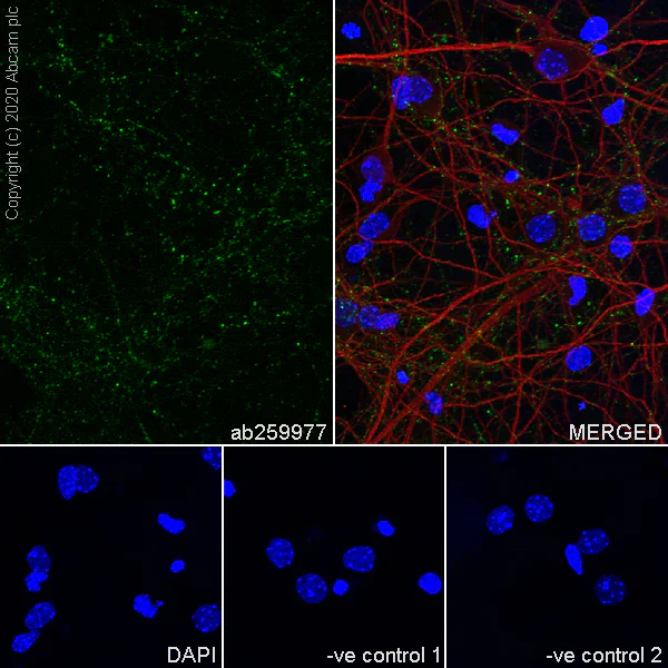 Immunocytochemistry/ Immunofluorescence - Anti-SYT2 + SYT1 antibody [EPR23920-2] - BSA and Azide free (AB277491)