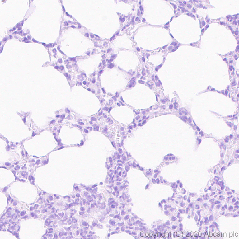 Immunohistochemistry (Formalin/PFA-fixed paraffin-embedded sections) - Anti-SYT2 + SYT1 antibody [EPR23920-2] - BSA and Azide free (AB277491)