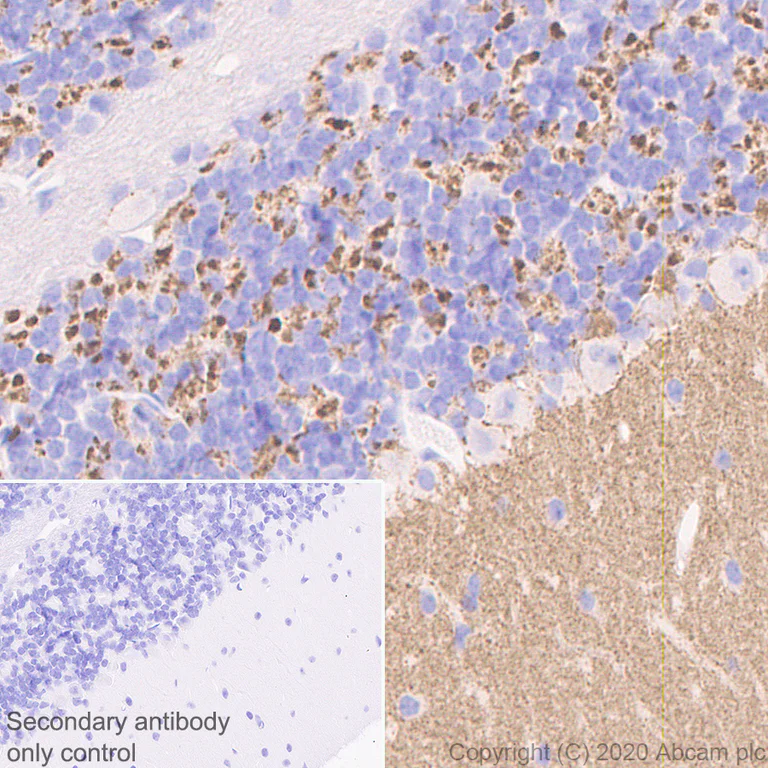 Immunohistochemistry (Formalin/PFA-fixed paraffin-embedded sections) - Anti-SYT2 + SYT1 antibody [EPR23920-2] - BSA and Azide free (AB277491)