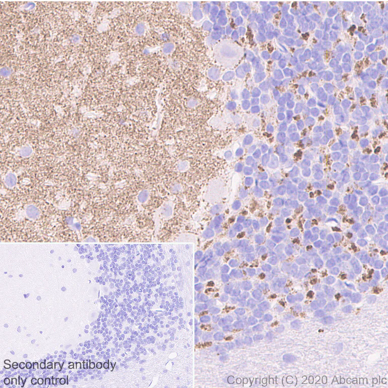 Immunohistochemistry (Formalin/PFA-fixed paraffin-embedded sections) - Anti-SYT2 + SYT1 antibody [EPR23920-2] - BSA and Azide free (AB277491)