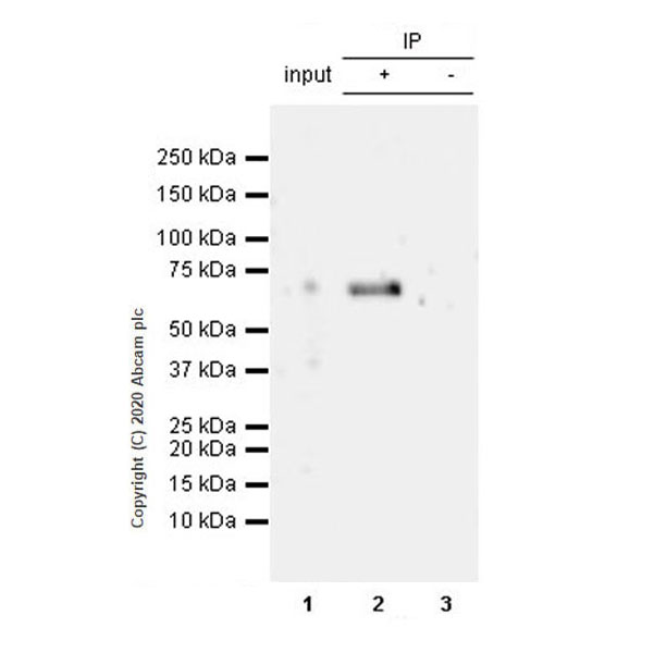 Immunoprecipitation - Anti-SYT2 + SYT1 antibody [EPR23920-2] - BSA and Azide free (AB277491)