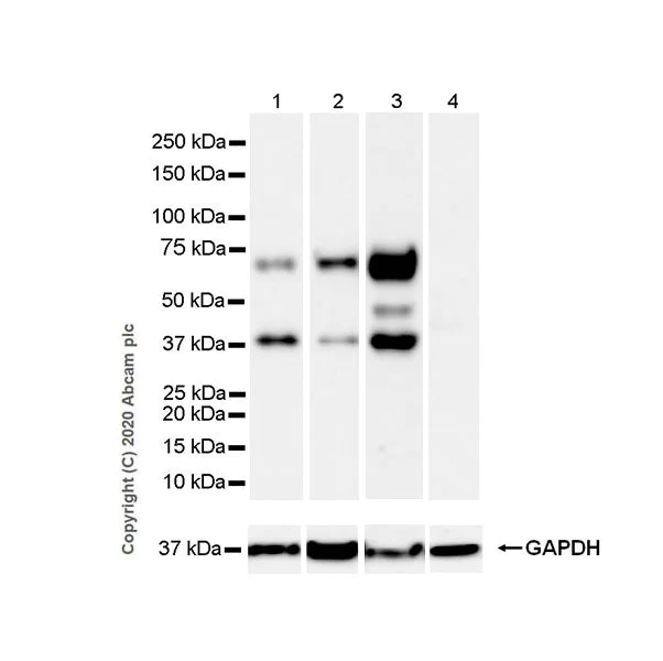 Western blot - Anti-SYT2 + SYT1 antibody [EPR23920-2] - BSA and Azide free (AB277491)