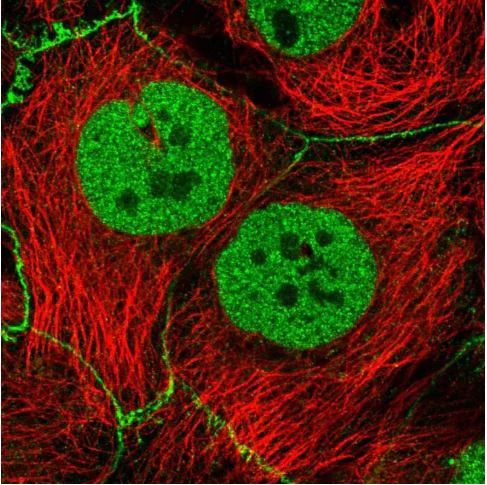 Immunocytochemistry/ Immunofluorescence - Anti-SYT8 antibody - N-terminal (AB185343)
