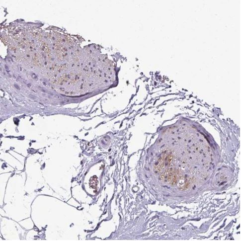 Immunohistochemistry (Formalin/PFA-fixed paraffin-embedded sections) - Anti-SYT8 antibody - N-terminal (AB185343)