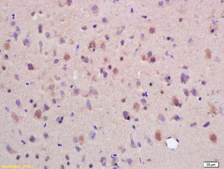 Immunohistochemistry (Formalin/PFA-fixed paraffin-embedded sections) - Anti-SYTL5 antibody (AB203218)