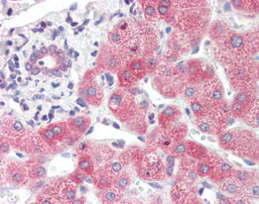 Immunohistochemistry (Formalin/PFA-fixed paraffin-embedded sections) - Anti-SYVN1/HRD1 antibody (AB118483)