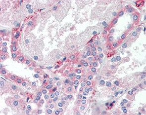 Immunohistochemistry (Formalin/PFA-fixed paraffin-embedded sections) - Anti-SYVN1/HRD1 antibody (AB118483)