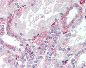 Immunohistochemistry (Formalin/PFA-fixed paraffin-embedded sections) - Anti-SYVN1/HRD1 antibody (AB118483)