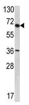 Western blot - Anti-SYVN1/HRD1 antibody (AB118483)
