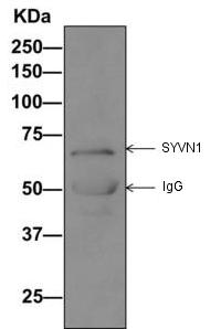 Immunoprecipitation - Anti-SYVN1/HRD1 antibody [EP7459] (AB170901), expandable thumbnail