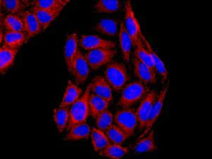 Immunocytochemistry/ Immunofluorescence - Anti-SYVN1/HRD1 antibody [EP7459] - BSA and Azide free (AB249578)