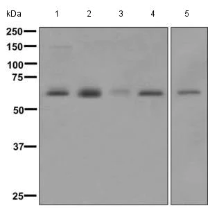 Western blot - Anti-SYVN1/HRD1 antibody [EP7459] - BSA and Azide free (AB249578)