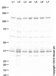 Western blot - T-47D whole cell lysate (AB14899), expandable thumbnail