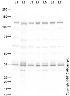 Western blot - T-47D whole cell lysate (AB14899)
