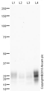 Western blot - T-47D whole cell lysate (AB14899), expandable thumbnail