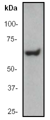 Western blot - T-47D whole cell lysate (ab14899), expandable thumbnail