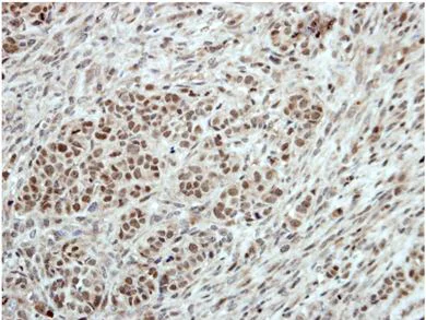 Immunohistochemistry (Formalin/PFA-fixed paraffin-embedded sections) - Anti-T-bet / Tbx21 antibody (AB154058)