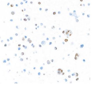 Immunocytochemistry - Anti-T-bet / Tbx21 antibody [BLR110H] (AB275959)