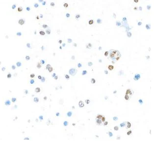 Immunocytochemistry - Anti-T-bet / Tbx21 antibody [BLR110H] (AB275959)