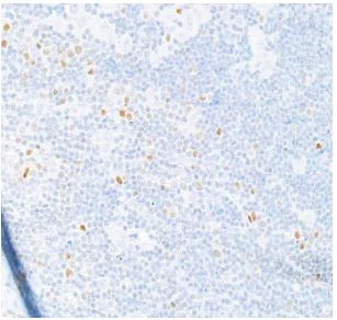 Immunohistochemistry (Formalin/PFA-fixed paraffin-embedded sections) - Anti-T-bet / Tbx21 antibody [BLR110H] (AB275959)