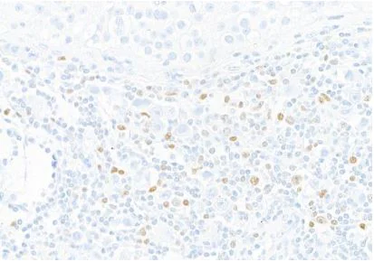 Immunohistochemistry (Formalin/PFA-fixed paraffin-embedded sections) - Anti-T-bet / Tbx21 antibody [BLR110H] (AB275959)