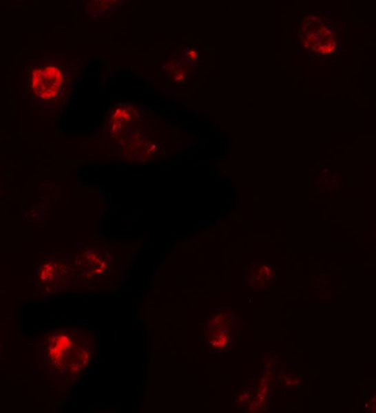 Immunocytochemistry/ Immunofluorescence - Anti-T-bet / Tbx21 antibody - C-terminal (AB181400), expandable thumbnail
