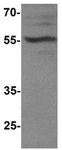 Western blot - Anti-T-bet / Tbx21 antibody - C-terminal (AB181400), expandable thumbnail