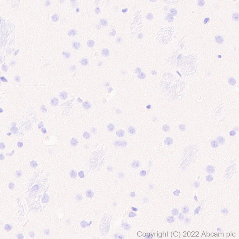 Immunohistochemistry (Formalin/PFA-fixed paraffin-embedded sections) - Anti-T-bet / Tbx21 antibody [EPR25086-9] - BSA and Azide free (AB300452)