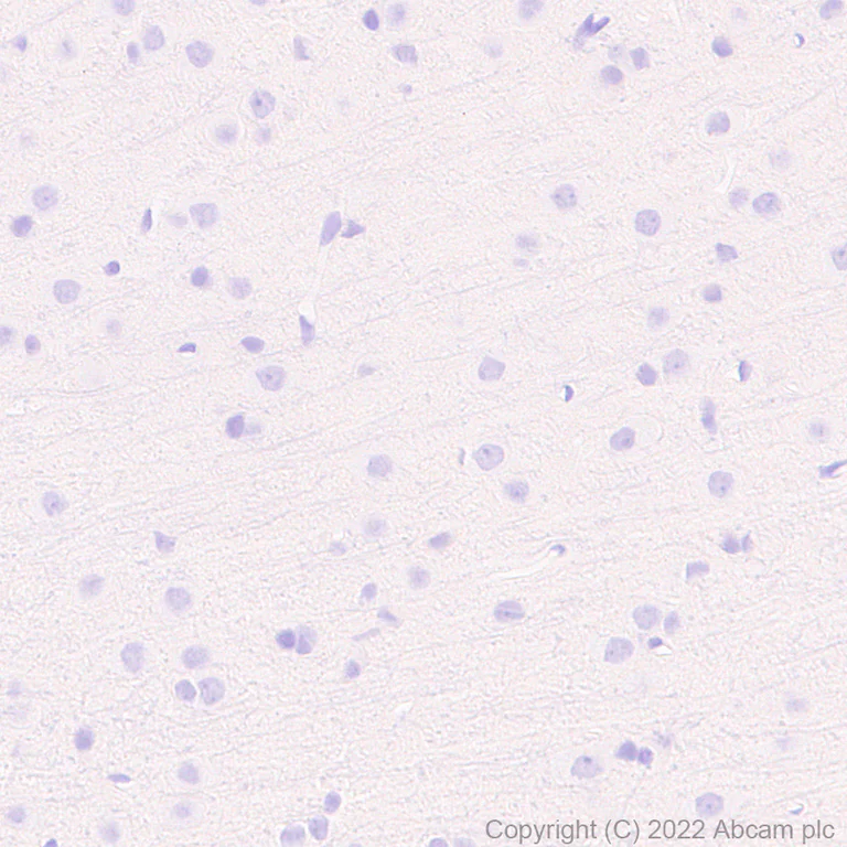 Immunohistochemistry (Formalin/PFA-fixed paraffin-embedded sections) - Anti-T-bet / Tbx21 antibody [EPR25086-9] - BSA and Azide free (AB300452)