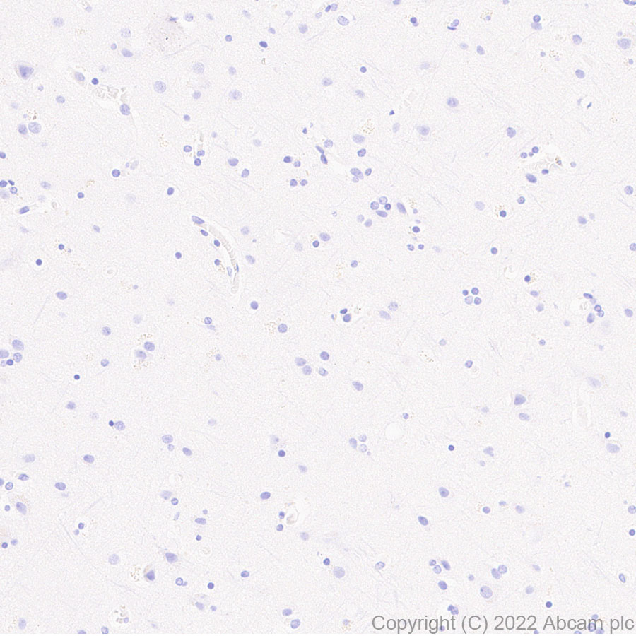 Immunohistochemistry (Formalin/PFA-fixed paraffin-embedded sections) - Anti-T-bet / Tbx21 antibody [EPR27094-16] (AB307193), expandable thumbnail