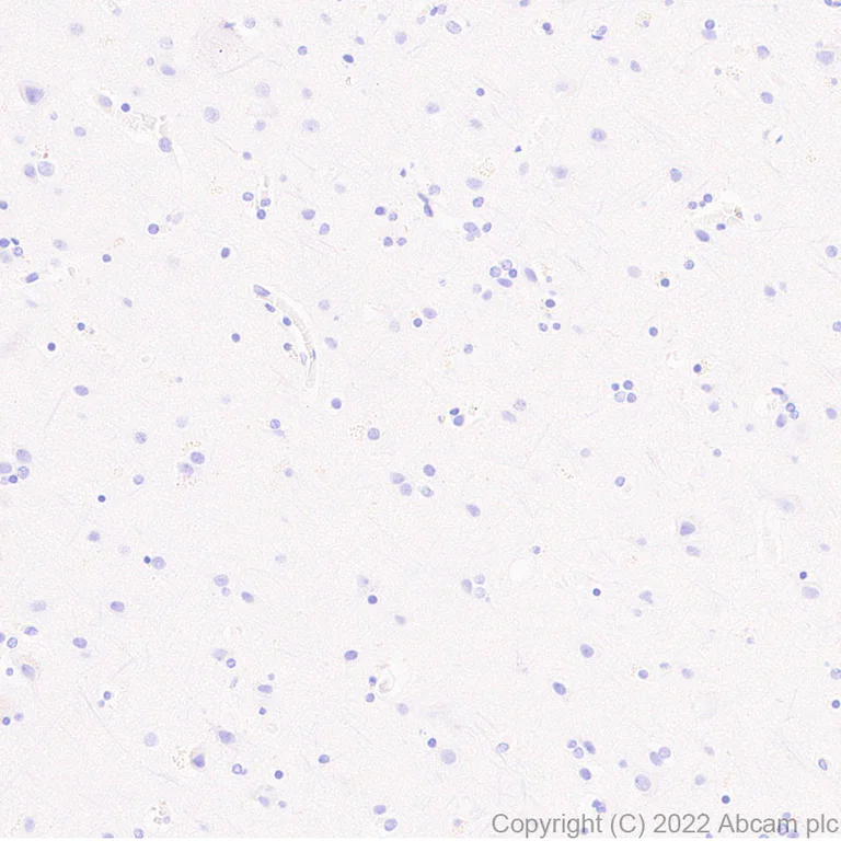 Immunohistochemistry (Formalin/PFA-fixed paraffin-embedded sections) - Anti-T-bet / Tbx21 antibody [EPR27094-16] (AB307193)