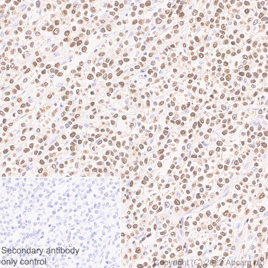 Immunohistochemistry (Formalin/PFA-fixed paraffin-embedded sections) - Anti-T-bet / Tbx21 antibody [EPR27094-16] (AB307193), expandable thumbnail