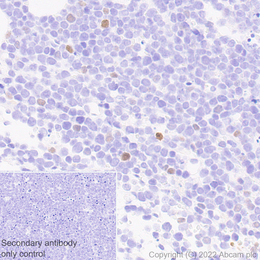 Immunohistochemistry (Formalin/PFA-fixed paraffin-embedded sections) - Anti-T-bet / Tbx21 antibody [EPR27094-16] (AB307193), expandable thumbnail