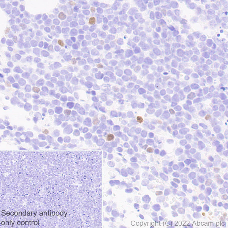 Immunohistochemistry (Formalin/PFA-fixed paraffin-embedded sections) - Anti-T-bet / Tbx21 antibody [EPR27094-16] (AB307193)