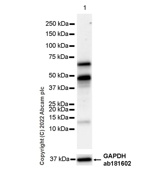 Western blot - Anti-T-bet / Tbx21 antibody [EPR27094-16] (ab307193), expandable thumbnail