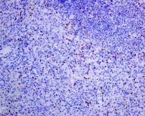 Immunohistochemistry (Formalin/PFA-fixed paraffin-embedded sections) - Anti-T-bet / Tbx21 antibody [EPR9301] (AB150440), expandable thumbnail
