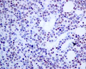 Immunohistochemistry (Formalin/PFA-fixed paraffin-embedded sections) - Anti-T-bet / Tbx21 antibody [EPR9301] (ab150440), expandable thumbnail