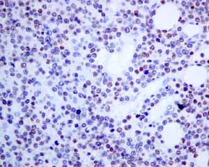 Immunohistochemistry (Formalin/PFA-fixed paraffin-embedded sections) - Anti-T-bet / Tbx21 antibody [EPR9301] (AB150440)