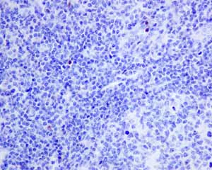 Immunohistochemistry (Formalin/PFA-fixed paraffin-embedded sections) - Anti-T-bet / Tbx21 antibody [EPR9301] - BSA and Azide free (AB227115)