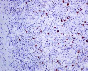 Immunohistochemistry (Formalin/PFA-fixed paraffin-embedded sections) - Anti-T-bet / Tbx21 antibody [EPR9301] - BSA and Azide free (AB227115)