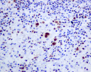 Anti-T-bet / Tbx21 antibody [EPR9302] Rabbit monoclonal