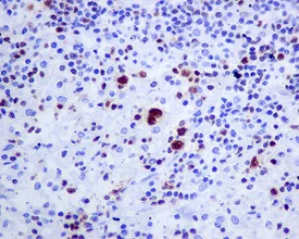 Immunohistochemistry (Formalin/PFA-fixed paraffin-embedded sections) - Anti-T-bet / Tbx21 antibody [EPR9302] - BSA and Azide free (AB222290)