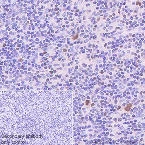 Immunohistochemistry (Formalin/PFA-fixed paraffin-embedded sections) - Anti-T-bet / Tbx21 antibody [EPR9302] - BSA and Azide free (AB222290)