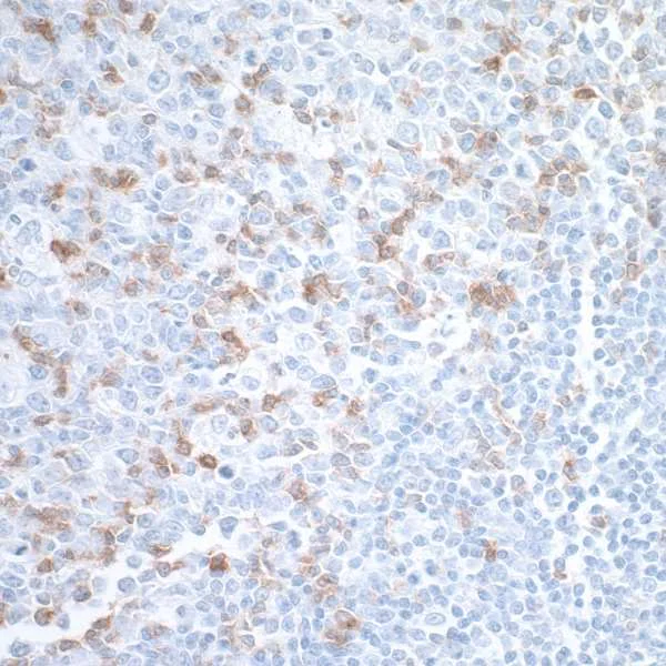 Immunohistochemistry (Formalin/PFA-fixed paraffin-embedded sections) - T Cell Exhaustion Marker (PD1, CTLA4, TIM3, LAG3, TIGIT) Antibody Panel - Human, IHC (AB254018)