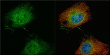 Immunocytochemistry/ Immunofluorescence - Anti-T Plastin/PLS3 antibody (AB137585)