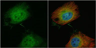 Immunocytochemistry/ Immunofluorescence - Anti-T Plastin/PLS3 antibody (AB137585)