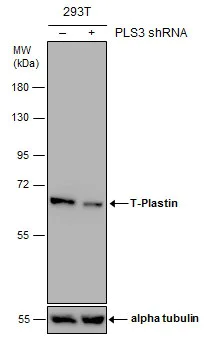 Western blot - Anti-T Plastin/PLS3 antibody (AB137585)