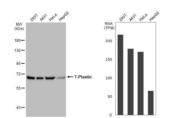 Western blot - Anti-T Plastin/PLS3 antibody (AB137585)