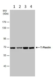 Western blot - Anti-T Plastin/PLS3 antibody (AB137585)
